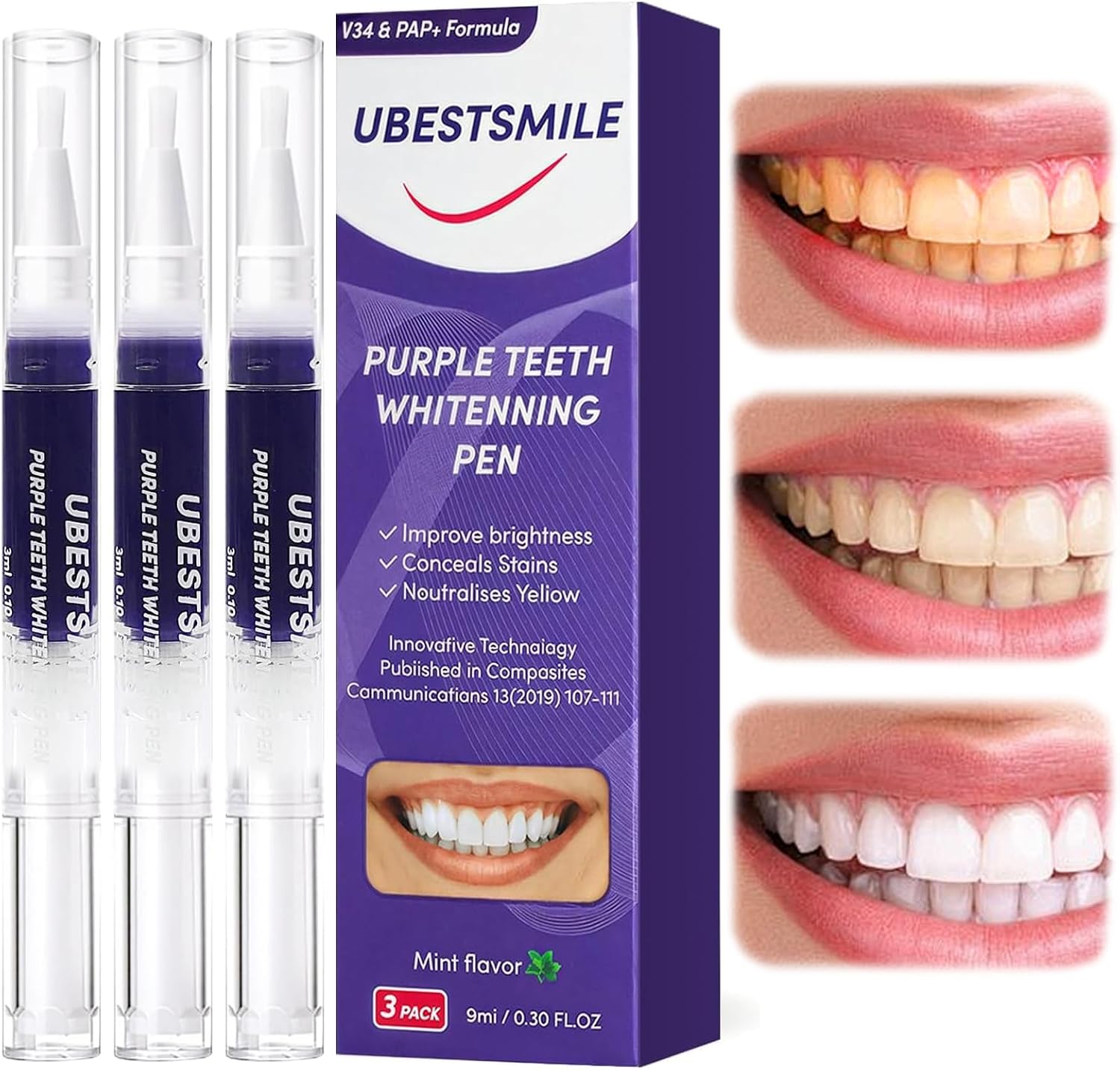UBESTSMILE V34&PAP+ Formula Pa - Teeth Whitening Pens recensie en prijs