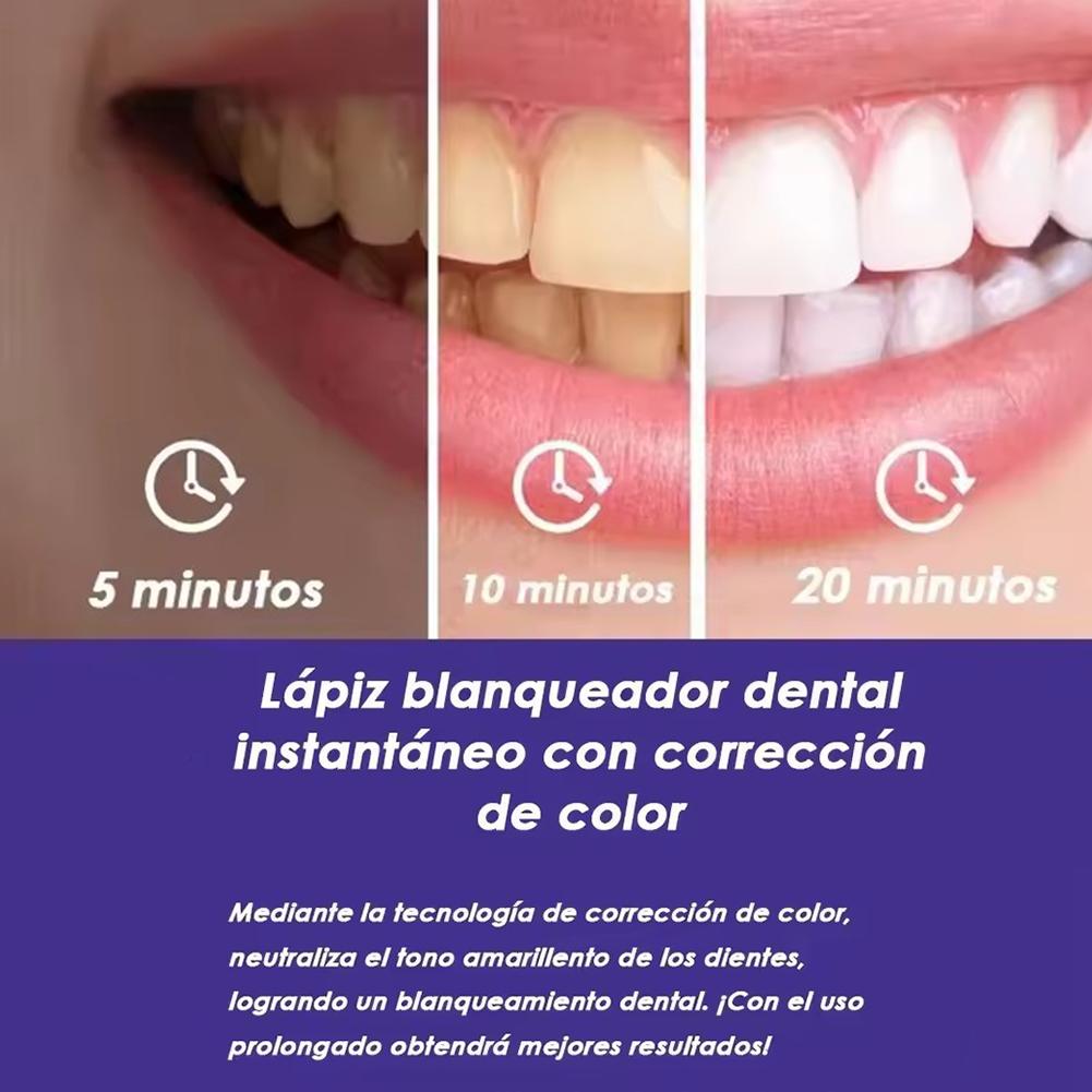 UBESTSMILE V34&PAP+ Formula Pa - Teeth Whitening Pens recensie en prijs