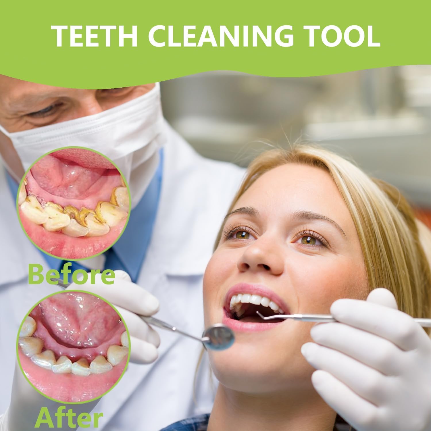 Professionele tandenreiniging  - Teeth Whitening Mouthwash recensie en prijs