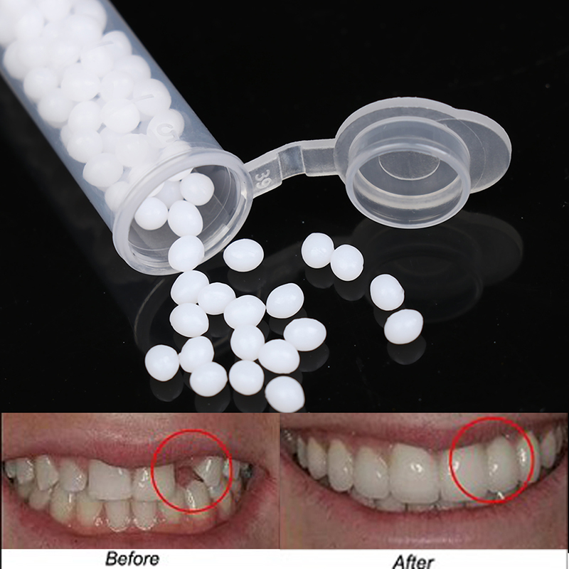 【K】1 doos tijdelijke tandrepar - Teeth Whitening Kit recensie en prijs