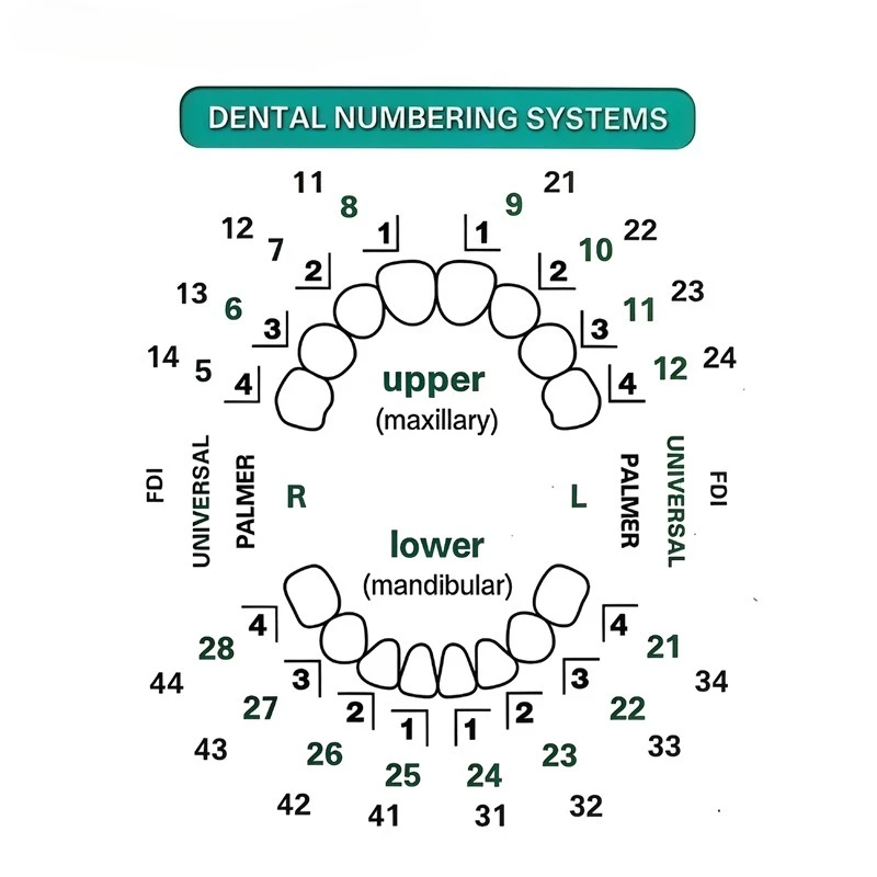 Tandvleugelvormset 32 stuks/se - Teeth Whitening Moulds recensie en prijs